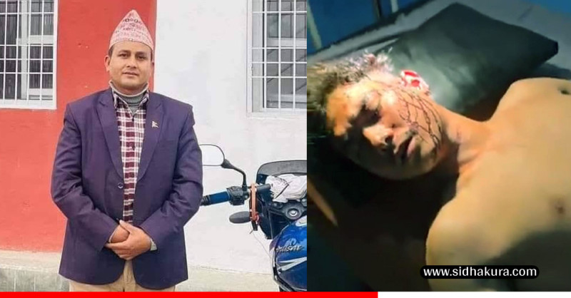 वडाध्यक्षमाथि युवकको टाउको फोरेको आरोप, घाइतेको टाउकोमा ८ टाँका