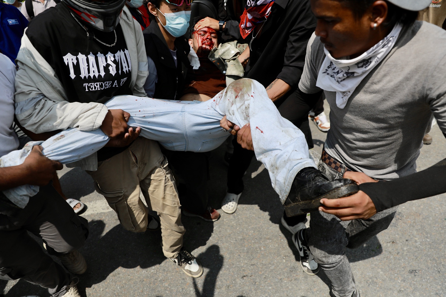 सरकारले अस्पतालहरुसँग माग्यो घाइते जेनजीहरुको विवरण