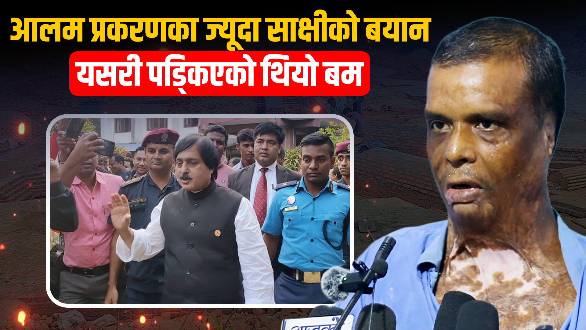 आलम प्रकरणका घाइते काठमाडौँमा, भन्छन्,– श्रीमान म जिउँदै छु, म साक्षी होइन स्वयं प्रमाण हुँ