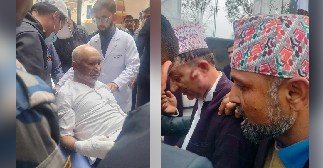 अर्थमन्त्री पौडेल र मेयर आचार्य आधा दर्जन विशेषज्ञ डाक्टरको निगरानीमा, कस्तो छ स्वास्थ्य अवस्था ?