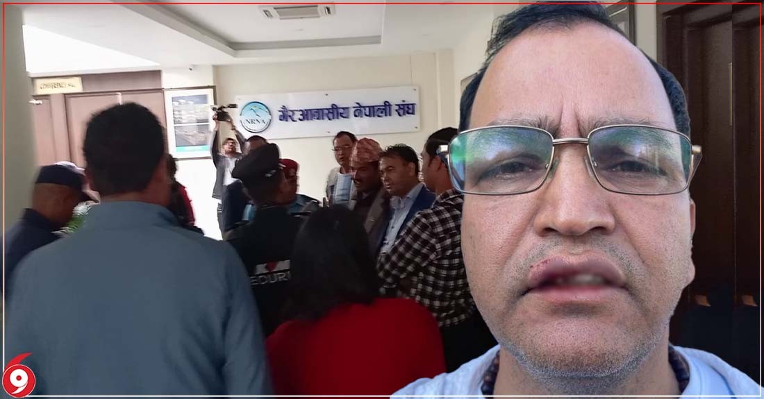 एनआरएनको कार्यालयमै युवासंघबाट एनआरएनका नेता कुटिए (भिडियाेसहित)